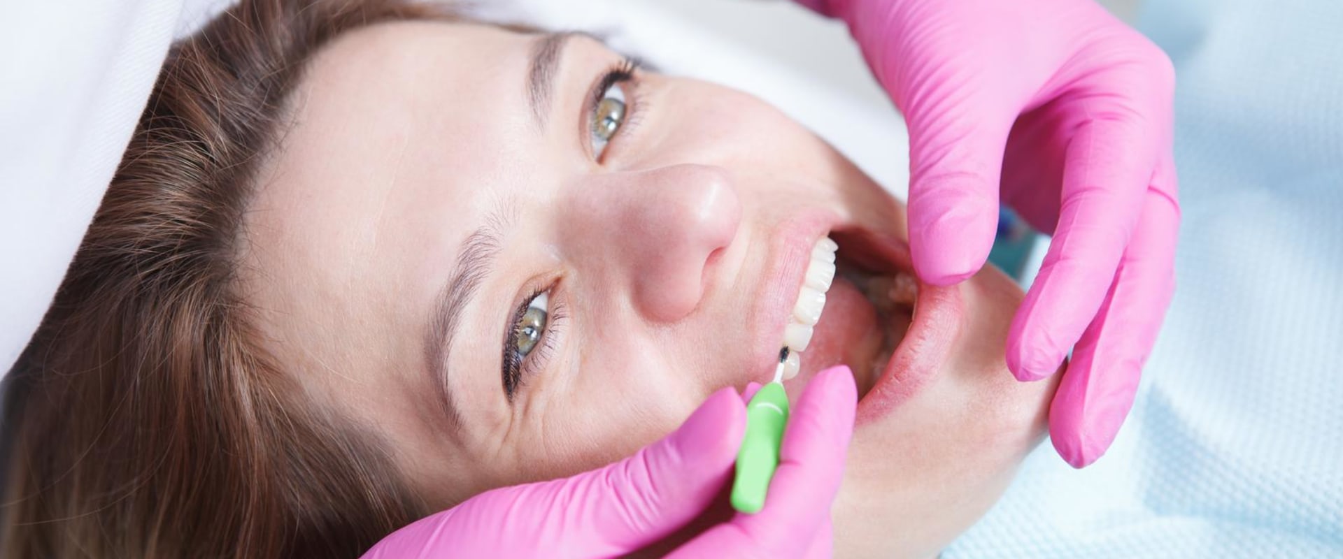 Navigating Dental Allergies: Your Guide To Comfortable Cleanings In Manassas Park, VA