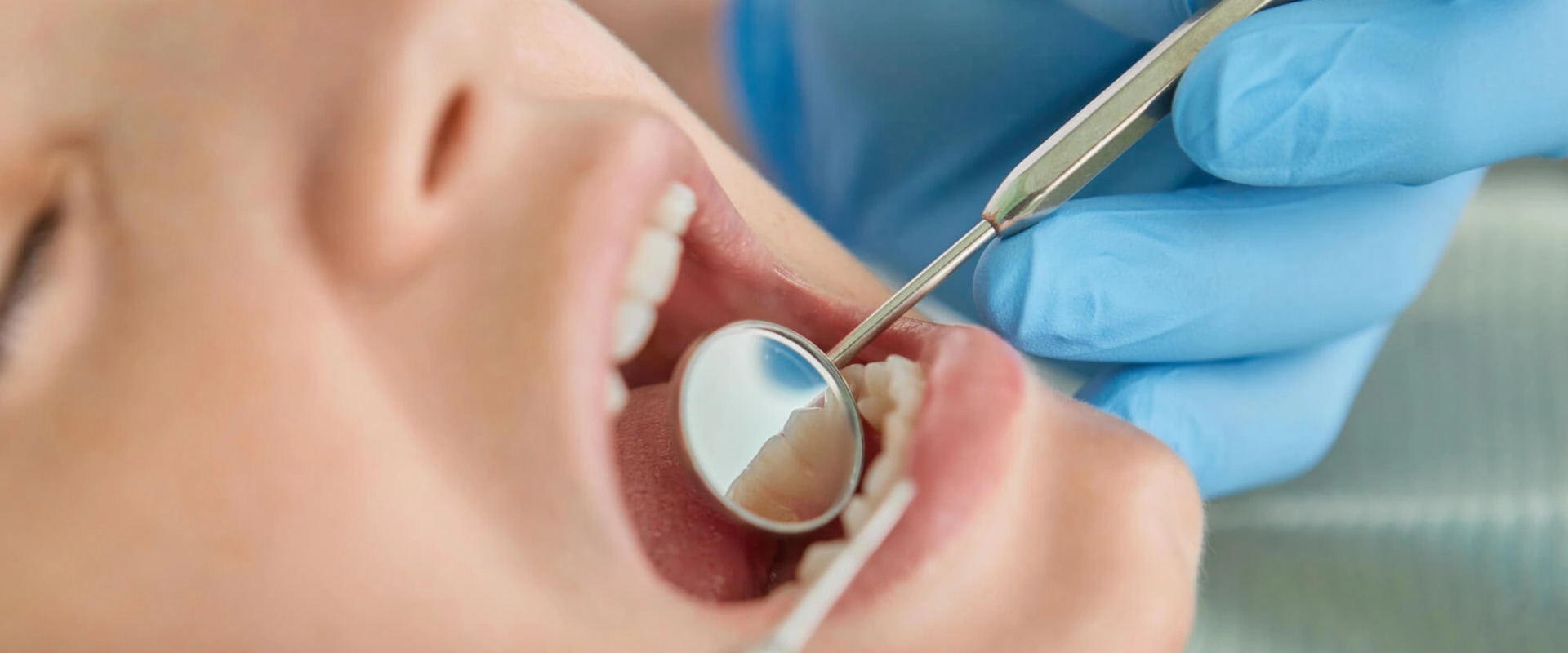 Urgent Medical Care in Charlotte, NC: What You Should Know About Dental Allergies and Emergency Visits