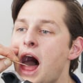 Treating Oral Allergies Naturally: A Guide for Allergy Sufferers
